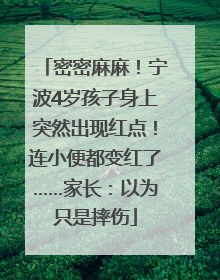 密密麻麻！宁波4岁孩子身上突然出现红点！连小便都变红了……家长：以为只是摔伤